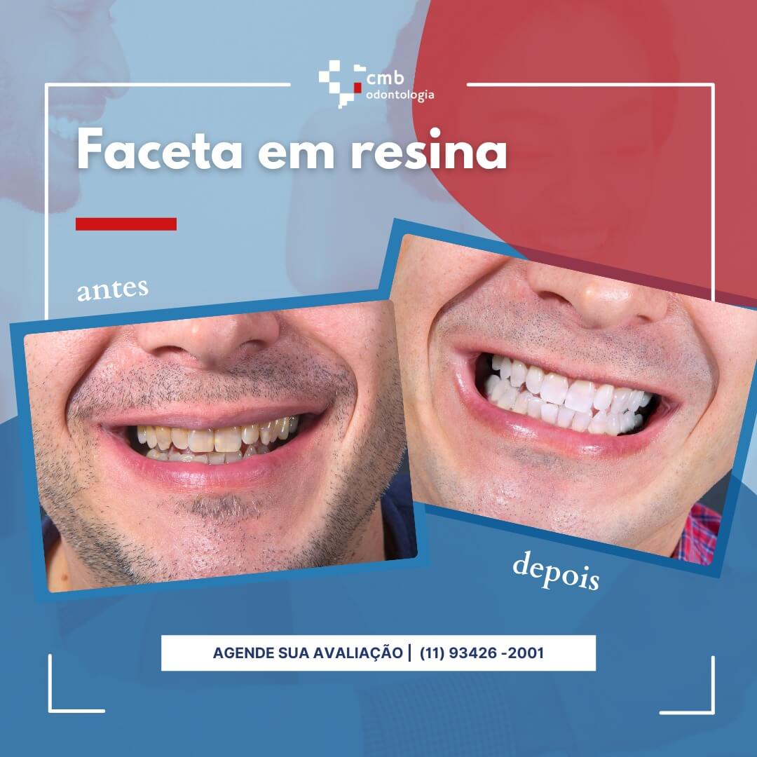 Dentista em Guarulhos