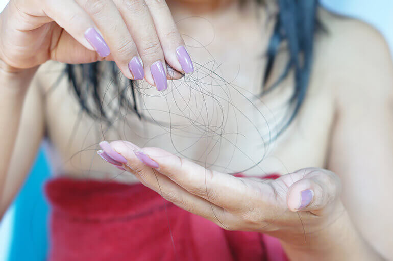 Tratamento para queda capilar