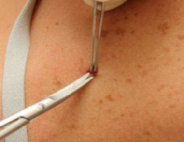 Dermatologista em Guarulhos