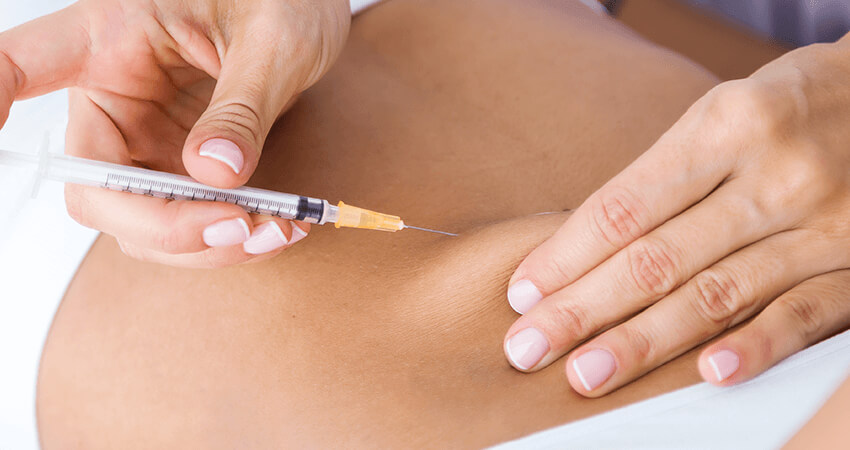 Lipoaspiração Enzimática em Guarulhos