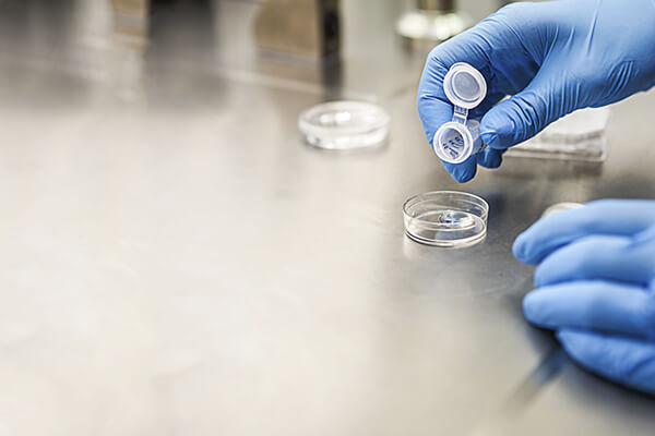 Inseminação artificial em Guarulhos