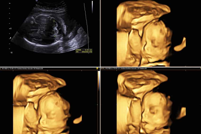 Ultrassom 4D em Guarulhos