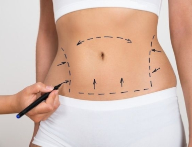 Cirurgia Plástica em Guarulhos