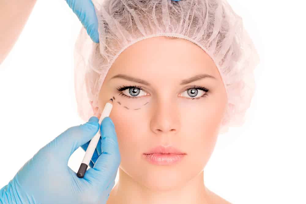 Blefaroplastia em Guarulhos