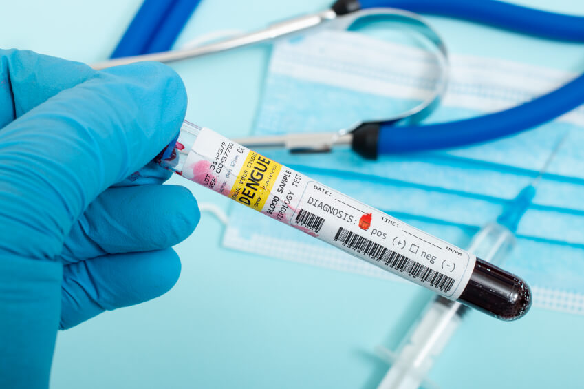 Teste Rápido de Dengue em Guarulhos Teste Rápido de Dengue em Guarulhos