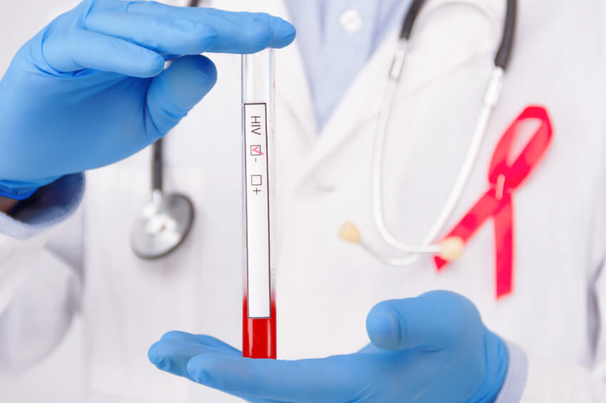 Teste Rápido de HIV em Guarulhos Teste Rápido de HIV em Guarulhos