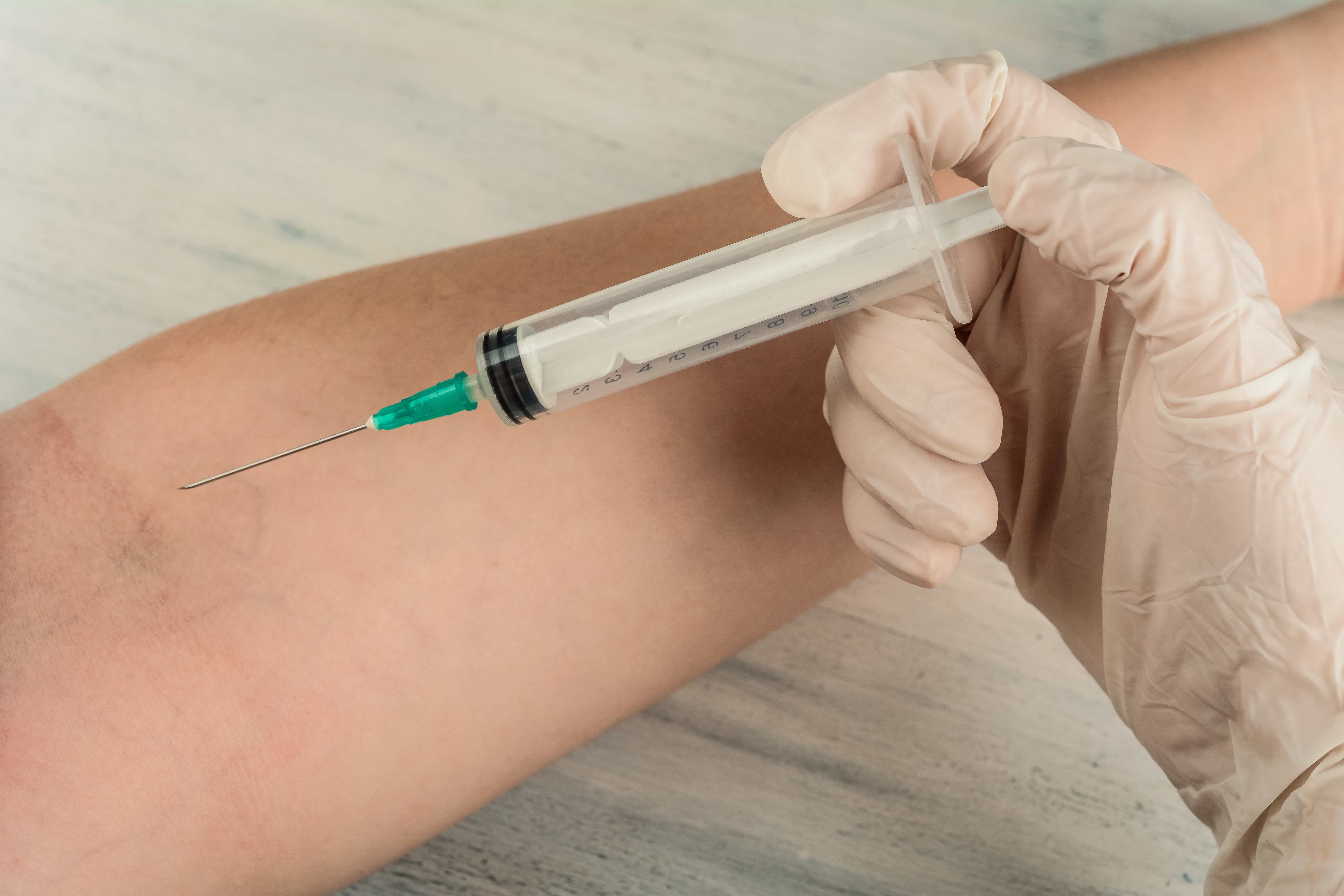 Vacina da Tuberculose em Guarulhos Vacina da Tuberculose em Guarulhos